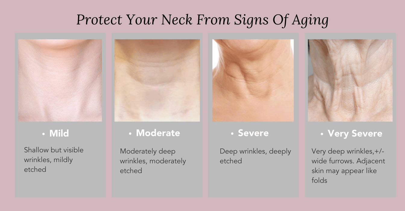 How to Treat, Reduce and Prevent Neck Wrinkles & Sagging